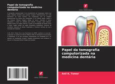 Buchcover von Papel da tomografia computorizada na medicina dentária