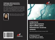 Inibizione dell'espressione dell'mRNA della telomerasi inversa umana的封面