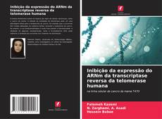 Borítókép a  Inibição da expressão do ARNm da transcriptase reversa da telomerase humana - hoz