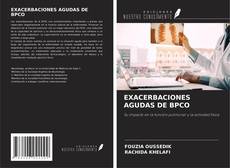 Copertina di EXACERBACIONES AGUDAS DE BPCO