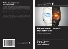Buchcover von Retención en prótesis maxilofaciales