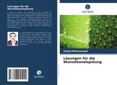 Copertina di Lösungen für die Wurzelkanalspülung