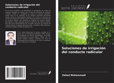 Bookcover of Soluciones de irrigación del conducto radicular
