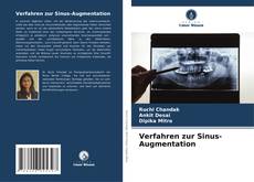 Copertina di Verfahren zur Sinus-Augmentation