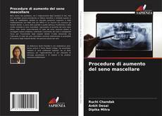 Borítókép a  Procedure di aumento del seno mascellare - hoz