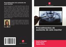 Bookcover of Procedimentos de aumento do seio maxilar