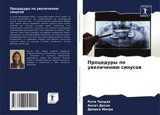 Bookcover of Процедуры по увеличению синусов
