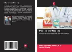 Bookcover of Osseodensificação