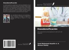 Bookcover of Oseodensificación
