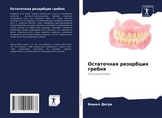 Bookcover of Остаточная резорбция гребня