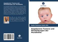 Copertina di Angeborene Tumore und Missbildungen der Mundhöhle