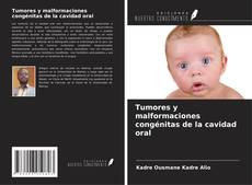 Bookcover of Tumores y malformaciones congénitas de la cavidad oral