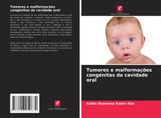 Buchcover von Tumores e malformações congénitas da cavidade oral