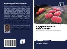 Bookcover of Внутричерепные менингиомы