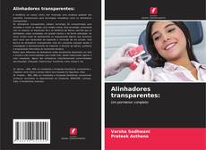 Couverture de Alinhadores transparentes: