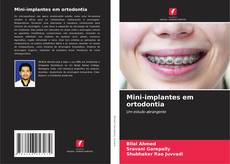 Mini-implantes em ortodontia kitap kapağı