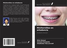 Buchcover von Minitornillos en ortodoncia