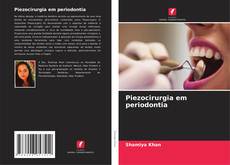 Buchcover von Piezocirurgia em periodontia