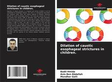 Bookcover of Dilation of caustic esophageal strictures in children.
