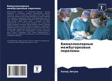 Couverture de Бималлеолярные межбугорковые переломы