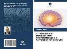Bookcover of CT-Befunde bei traumatischen Hirnverletzungen in Korrelation mit dem GCS