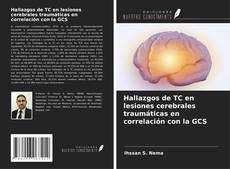 Bookcover of Hallazgos de TC en lesiones cerebrales traumáticas en correlación con la GCS