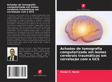 Bookcover of Achados de tomografia computorizada em lesões cerebrais traumáticas em correlação com a GCS