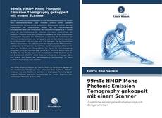 99mTc HMDP Mono Photonic Emission Tomography gekoppelt mit einem Scanner的封面