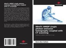 Buchcover von 99mTc HMDP single photon emission tomography coupled with CT scanning