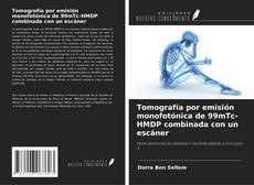 Bookcover of Tomografía por emisión monofotónica de 99mTc-HMDP combinada con un escáner