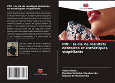 Copertina di PRF : la clé de résultats dentaires et esthétiques stupéfiants