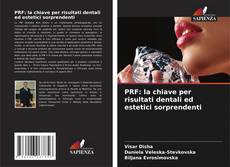 Couverture de PRF: la chiave per risultati dentali ed estetici sorprendenti