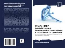 Bookcover of 99mTc-HMDP однофотонная эмиссионная томография в сочетании со сканером