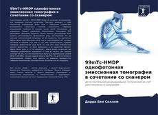 Capa do livro de 99mTc-HMDP однофотонная эмиссионная томография в сочетании со сканером 