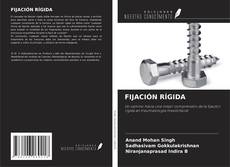 Couverture de FIJACIÓN RÍGIDA