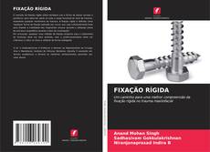 Capa do livro de FIXAÇÃO RÍGIDA 