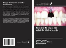 Buchcover von Terapia de implante asistida digitalmente