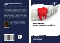 Bookcover of Увеличение альвеолярного гребня