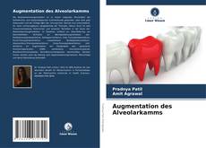 Обложка Augmentation des Alveolarkamms
