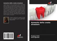 Capa do livro de Aumento della cresta alveolare 