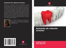 Buchcover von Aumento do rebordo alveolar