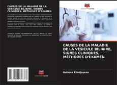 Copertina di CAUSES DE LA MALADIE DE LA VÉSICULE BILIAIRE, SIGNES CLINIQUES, MÉTHODES D'EXAMEN