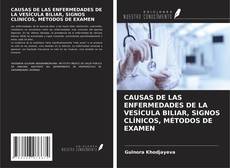 Buchcover von CAUSAS DE LAS ENFERMEDADES DE LA VESÍCULA BILIAR, SIGNOS CLÍNICOS, MÉTODOS DE EXAMEN