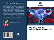 Portada del libro de Erkrankungen der polyzystischen Eierstöcke