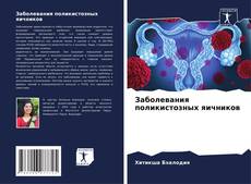 Portada del libro de Заболевания поликистозных яичников