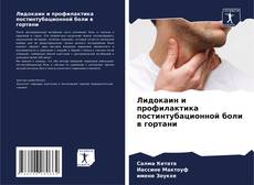 Buchcover von Лидокаин и профилактика постинтубационной боли в гортани