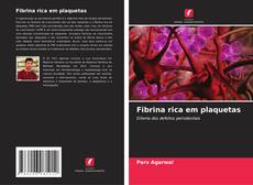 Fibrina rica em plaquetas的封面