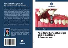 Copertina di Parodontalbehandlung bei periimplantären Erkrankungen