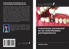 Couverture de Tratamiento periodontal de las enfermedades periimplantarias