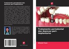 Copertina di Tratamento periodontal das doenças peri-implantares